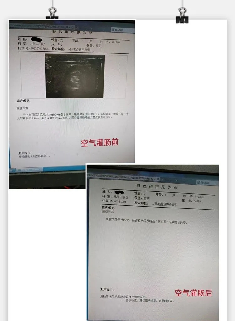 058bf53243bc8348614b3653ef577e8f_640_wx_fmt=jpeg&from=appmsg&tp=webp&wxfrom=5&wx_lazy=1&wx_co=1.webp